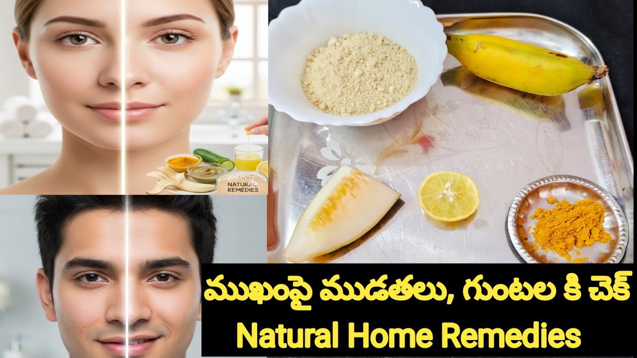 ముఖంపై ముడతలు, గుంటలు పోవాలంటే ఇవి ట్రై చేయండి || Natural Best Home Remedies for Wrinkles & Pores 