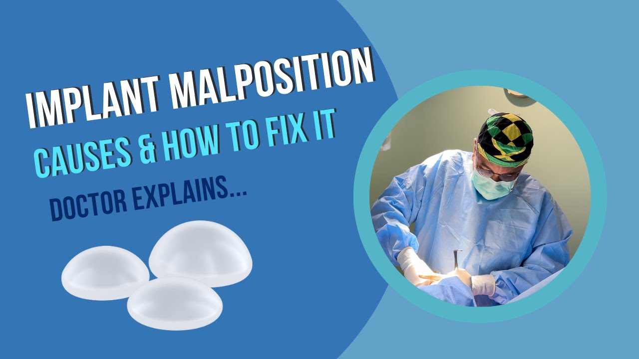 Breast Implant Malposition: Causes & How to Fix It | Dr. Spence Explains!