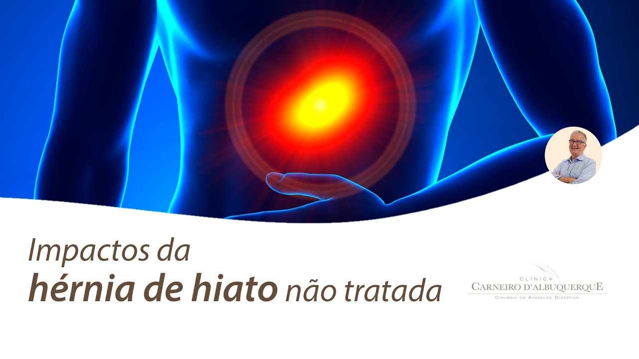 Impactos da hérnia de hiato não tratada | Prof. Dr. Luiz Carneiro CRM 22761