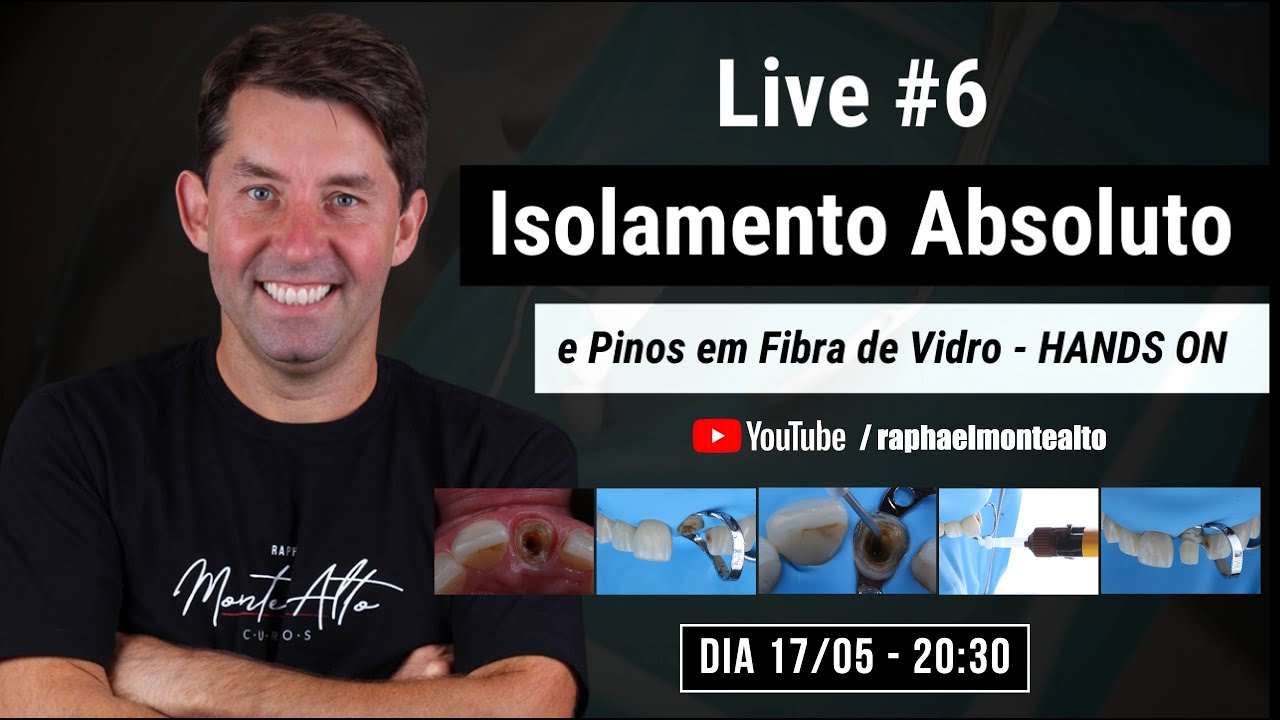 Live - Isolamento Absoluto e pinos em fibra de vidro.