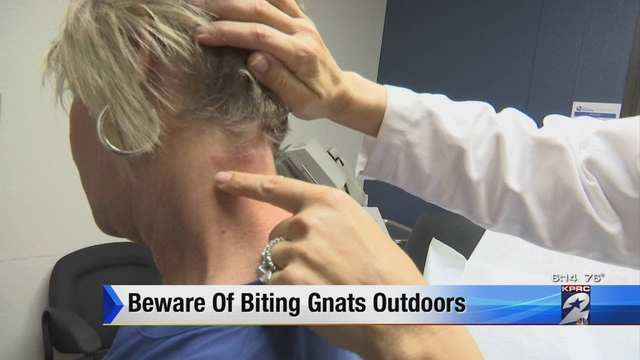 Beware of biting gnats outdoors