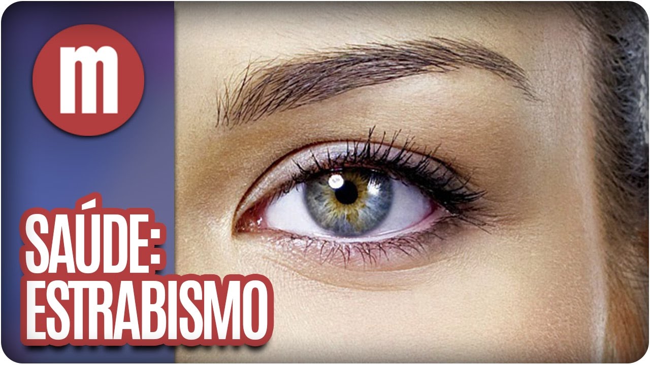 Estrabismo - Mulheres (04/10/16)