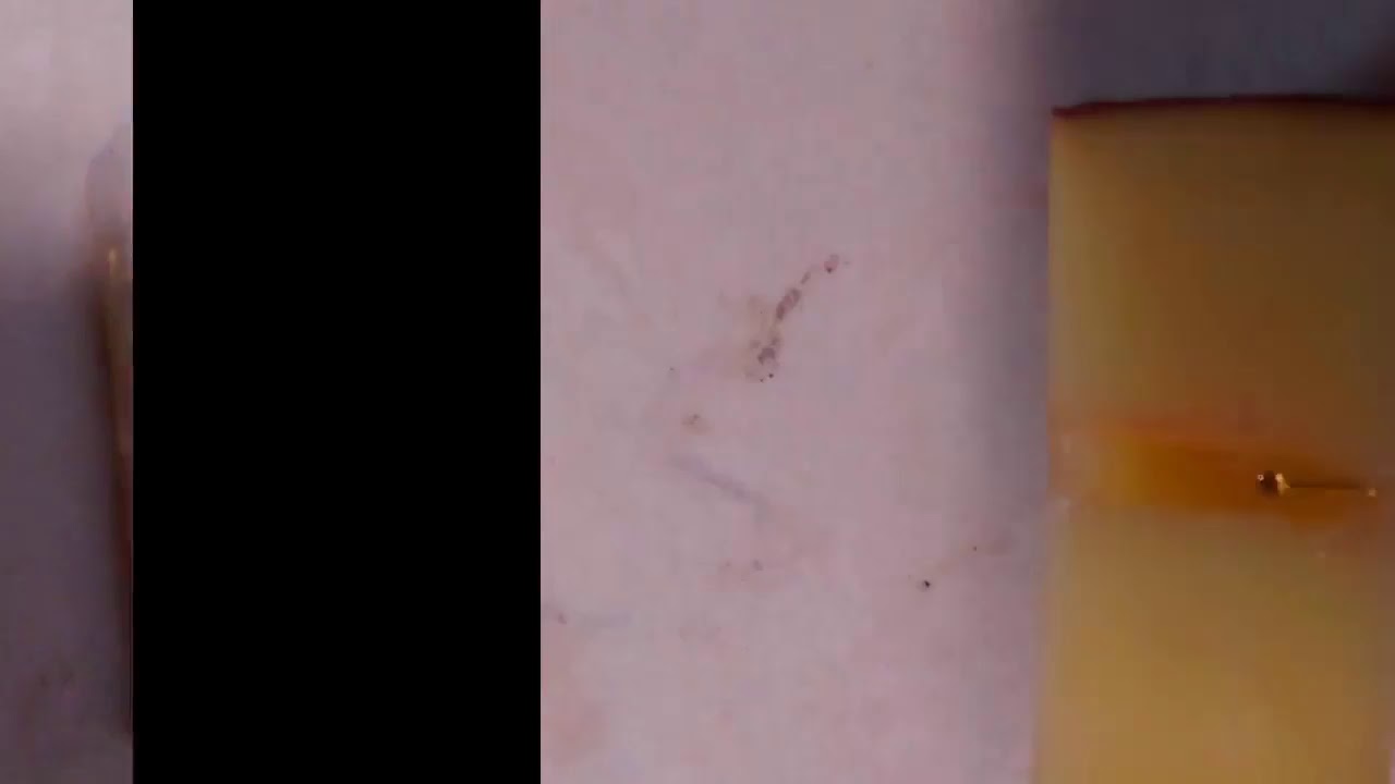 Cum faci o taparina 1