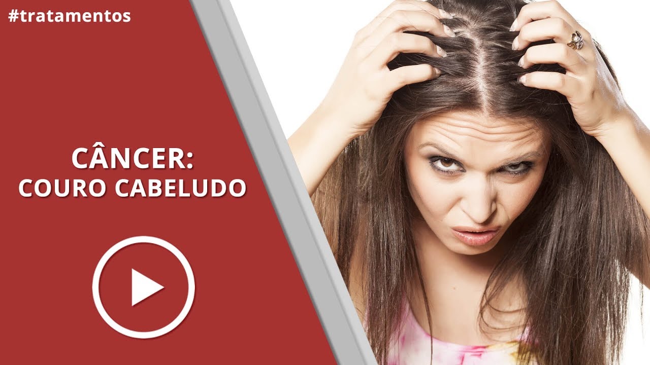 Câncer no Couro cabeludo - Dermatologista Erasmo Tokarski | #36