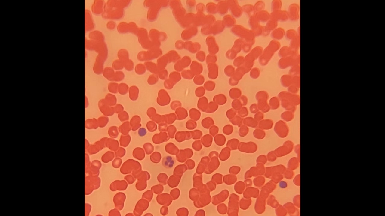 Blood part 1