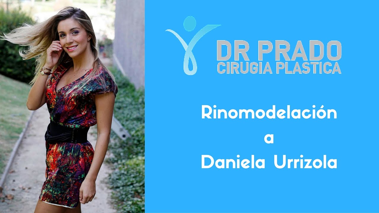 Rinomodelaci&oacute;n a Daniela Urrizola - Dr. Roberto Prado Sanhueza