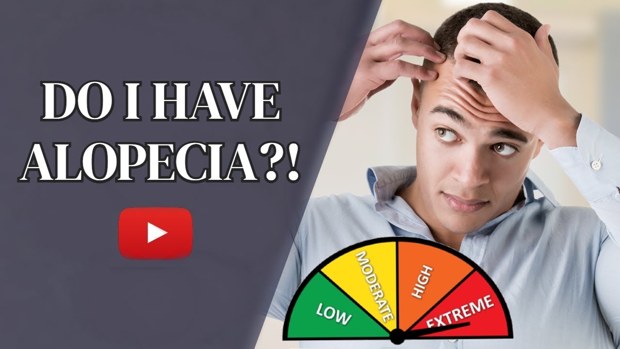 Discovering the Unexpected Signs of Alopecia [5 Symptoms]