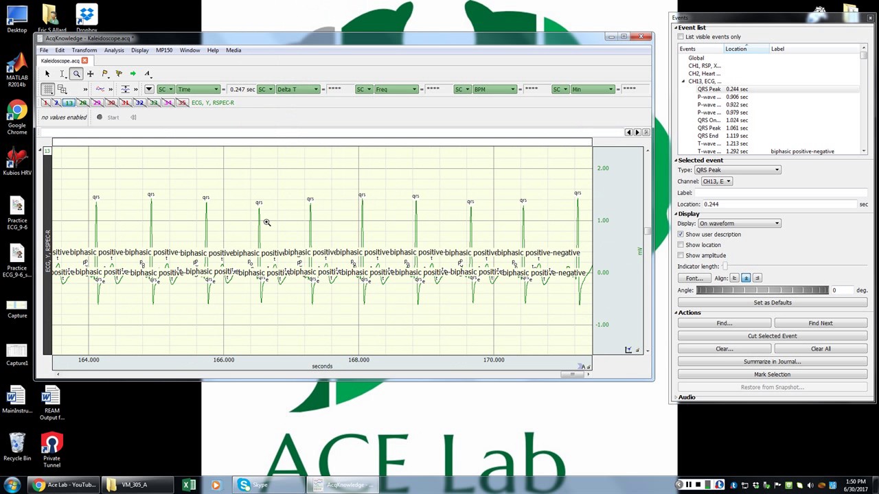 HRV/RSA in Acqknowledge and Kubios with a clean signal