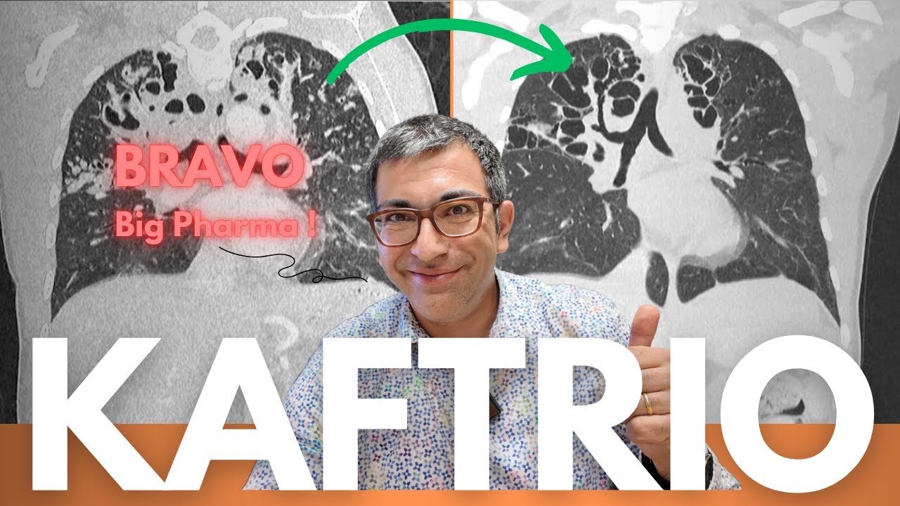Mucoviscidose : l'effet positif spectaculaire du Kaftrio en SCANNER thoracique