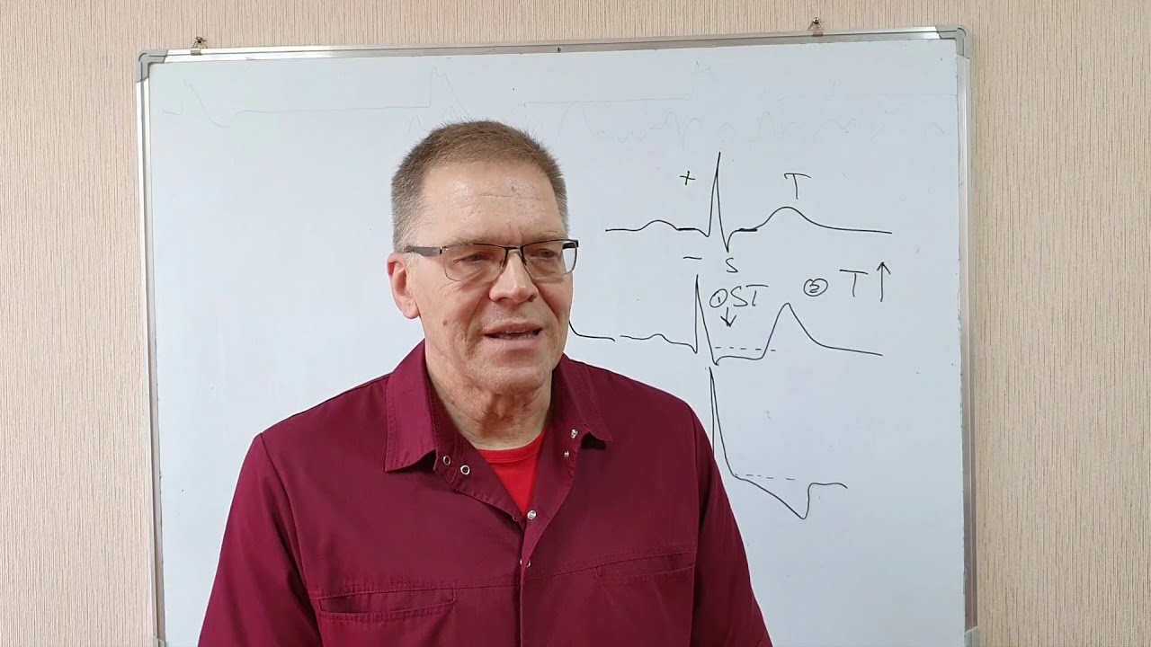 ЭКГ при ишемии, повреждении и инфаркте миокарда.