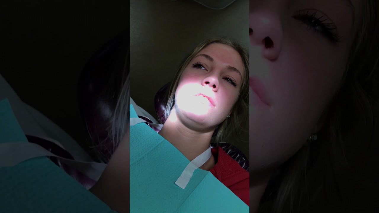Local Anesthesia for the Dental Hygiene Student