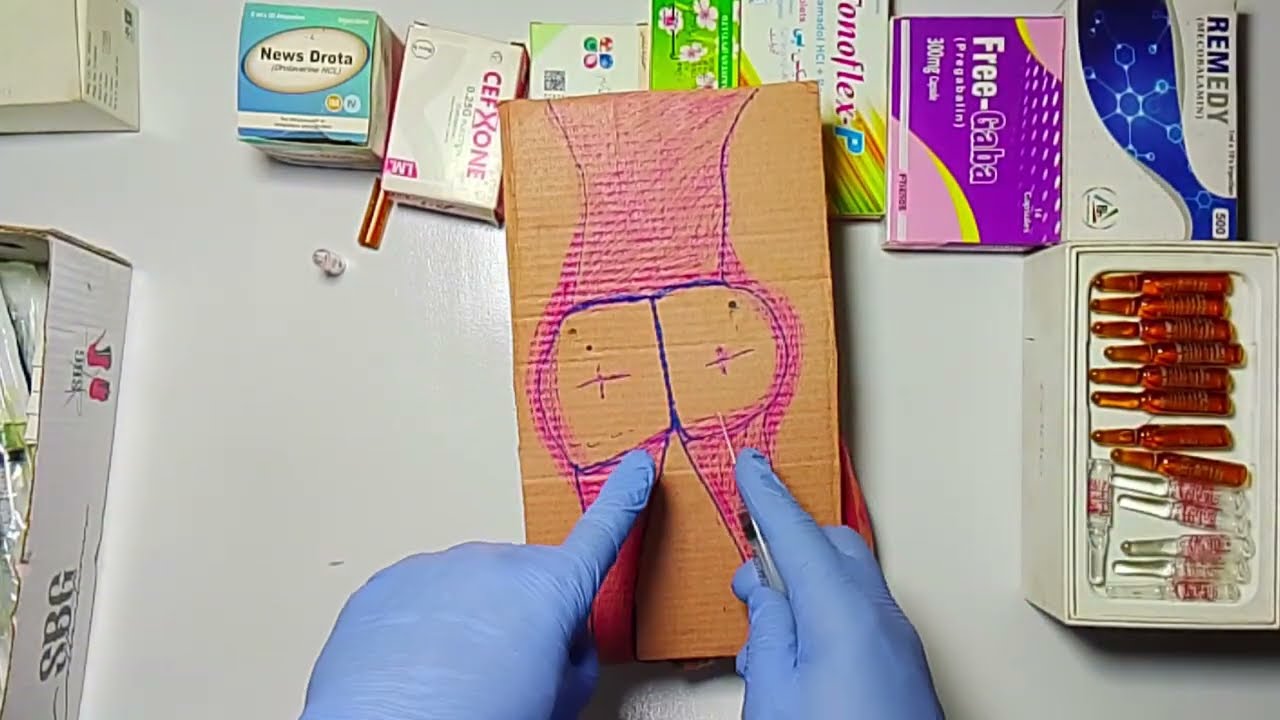 How to Perform a Safe Ventrogluteal IM Injection | Step-by-Step Clinical Guide