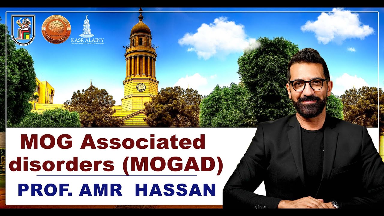 MOGAD- أ.د. عمرو حسن الحسني أستاذ المخ و الأعصاب