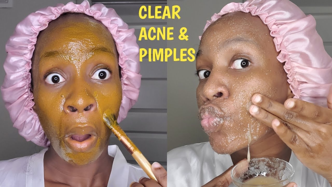 🔥Watch⚠️ before USING TURMERIC & SUGAR on FACE|Jalia Walda