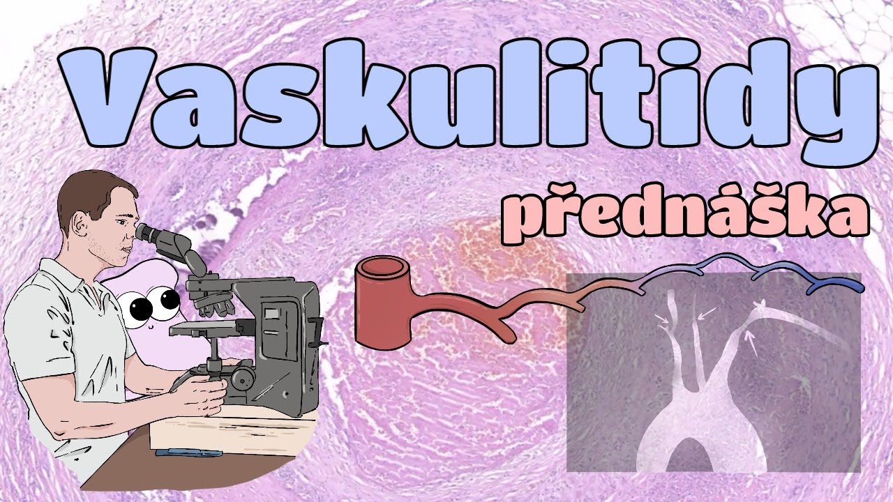 Patologie - Vaskulitidy (CZ)