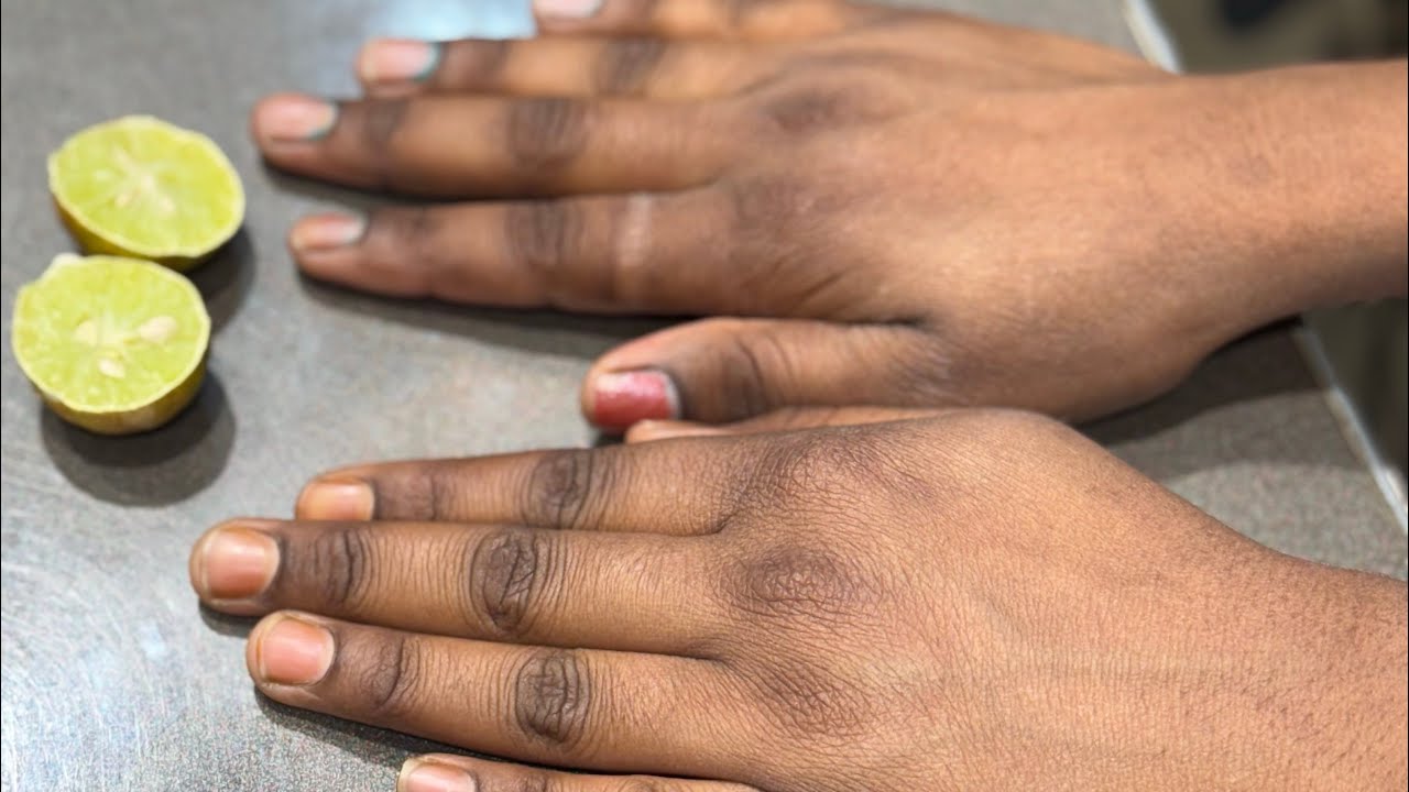 Hand and Body Tan Removing Easy Home Remedy. 💯 % Effective Results.