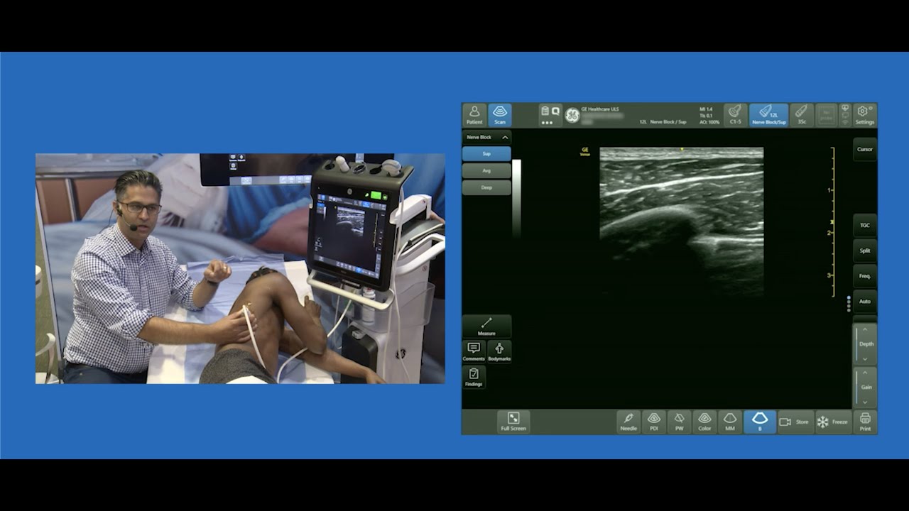 Serratus Anterior Plane Block