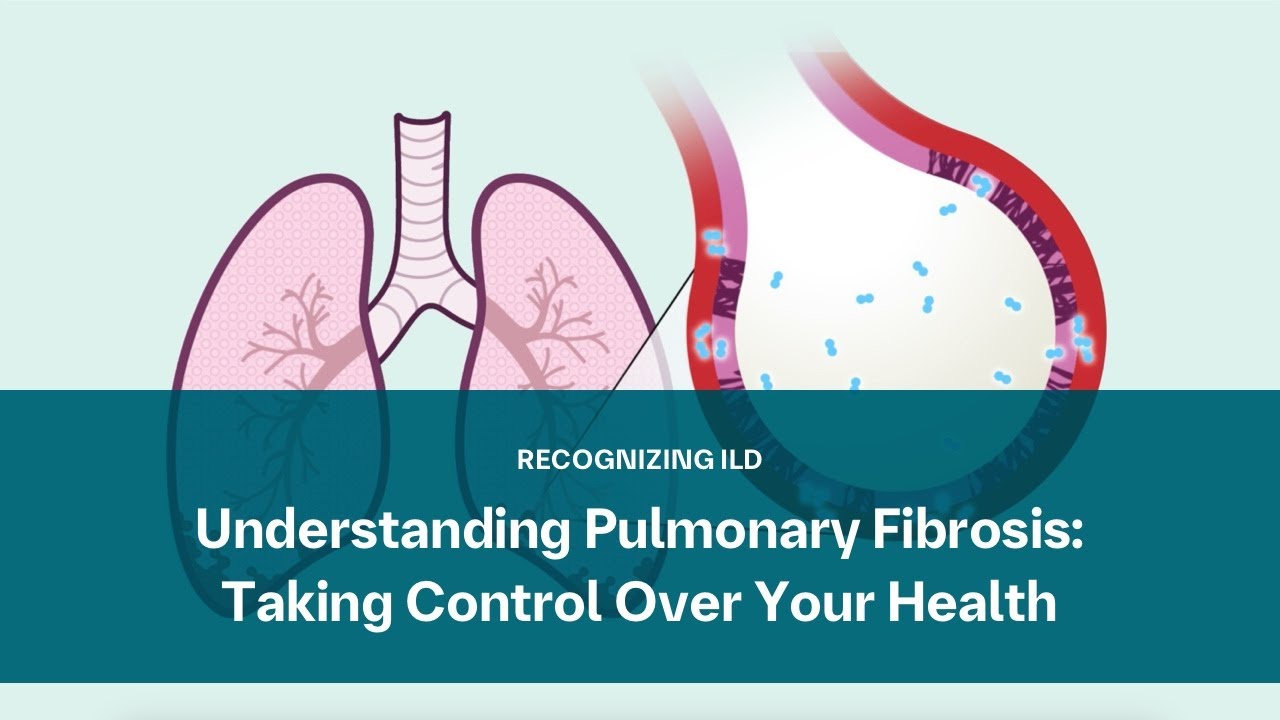 Understanding Pulmonary Fibrosis: Taking Control Over Your Health