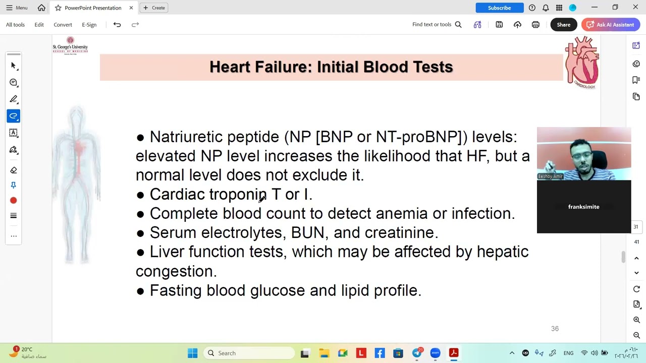 Heart Failure | Right vs Left side failure part 2 of 2