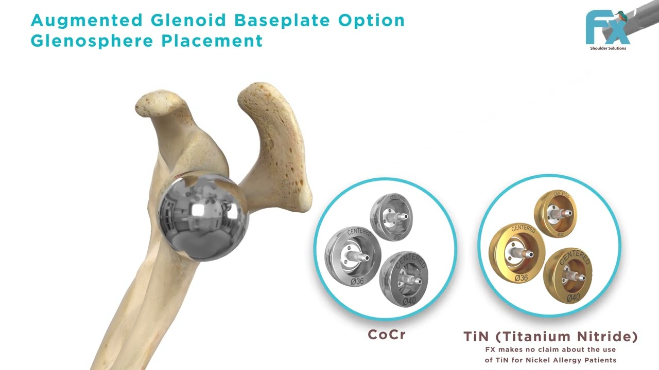 FX Shoulder Reverse System - 3D Orthopedic Animation by Pulse 3D Media