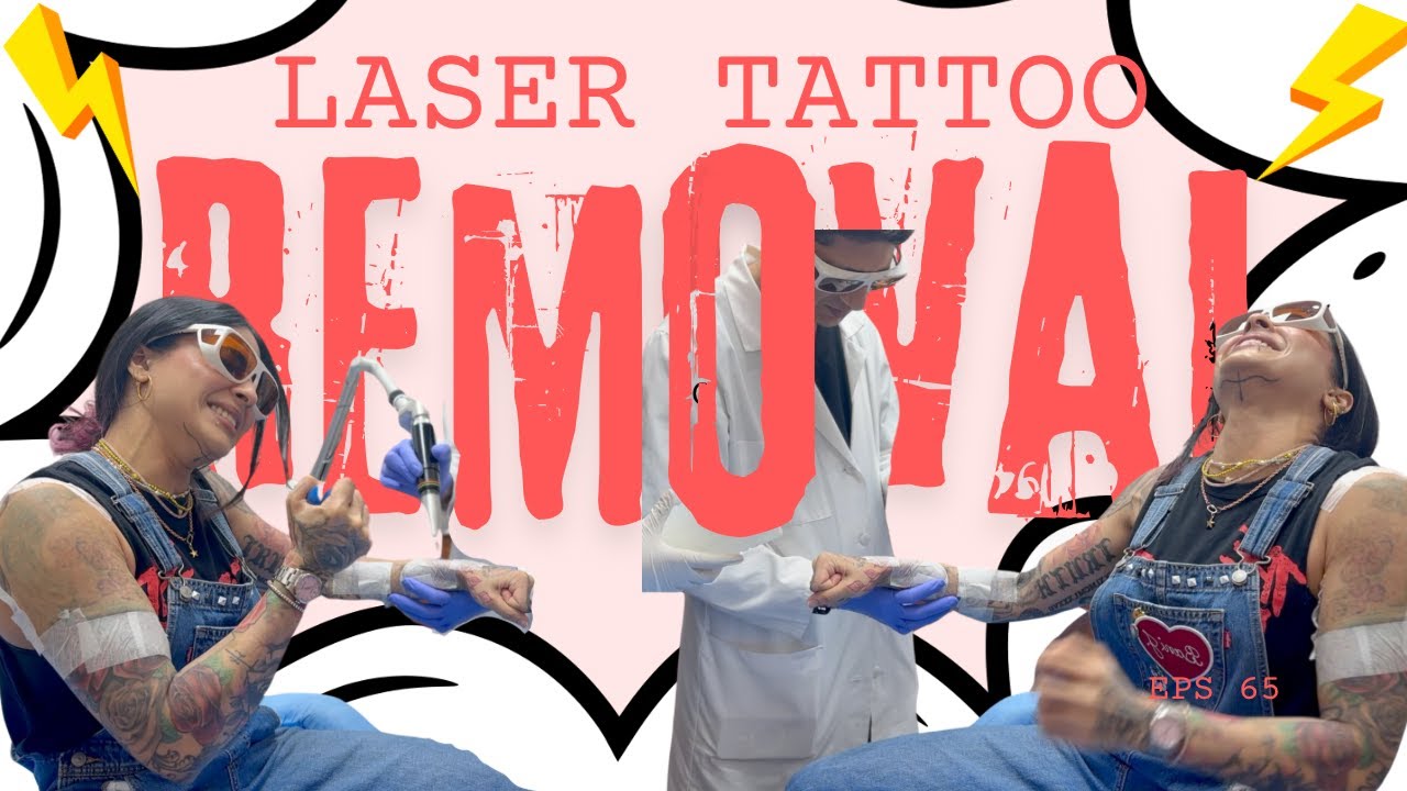 A Typical Laser Tattoo Removal Session with @drkmkapoor