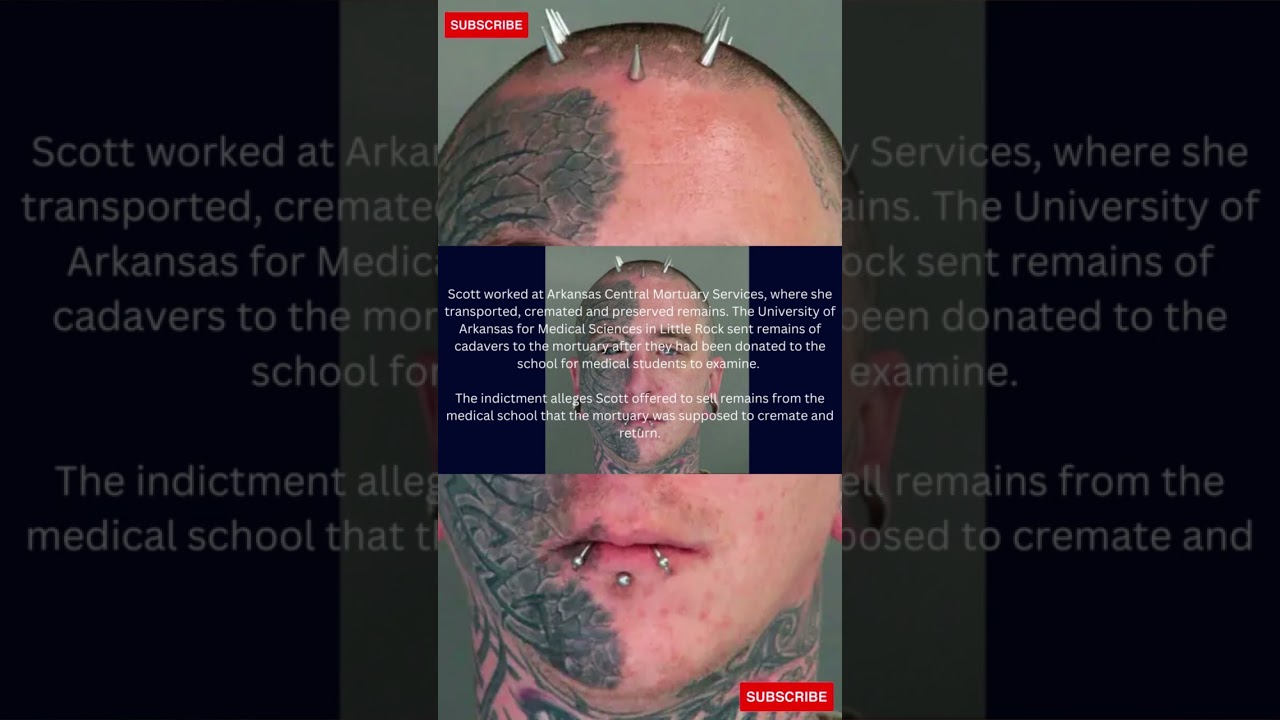 Mortuary Employee Sells $11,000 Worth Of Stolen Body Parts To Man Through Facebook