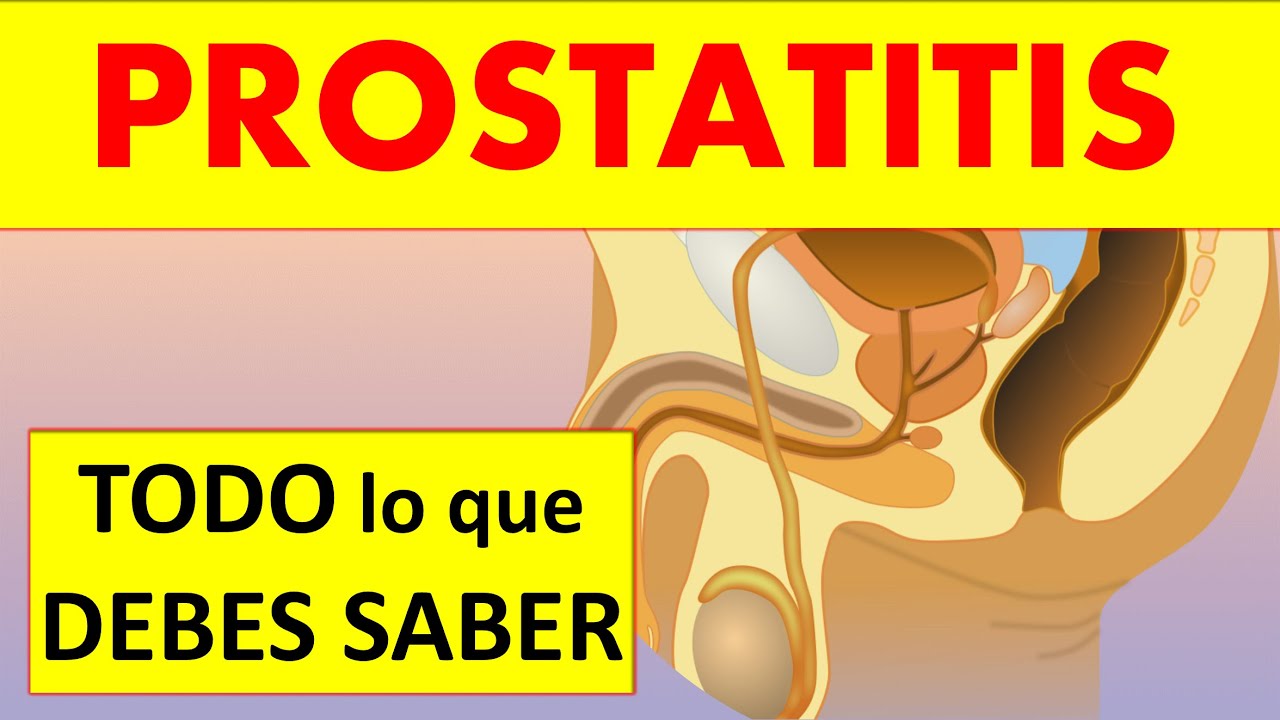 👨🙎‍ ¿Tienes PROSTATITIS? Descubre los 4 TIPOS y cómo TRATARLOS