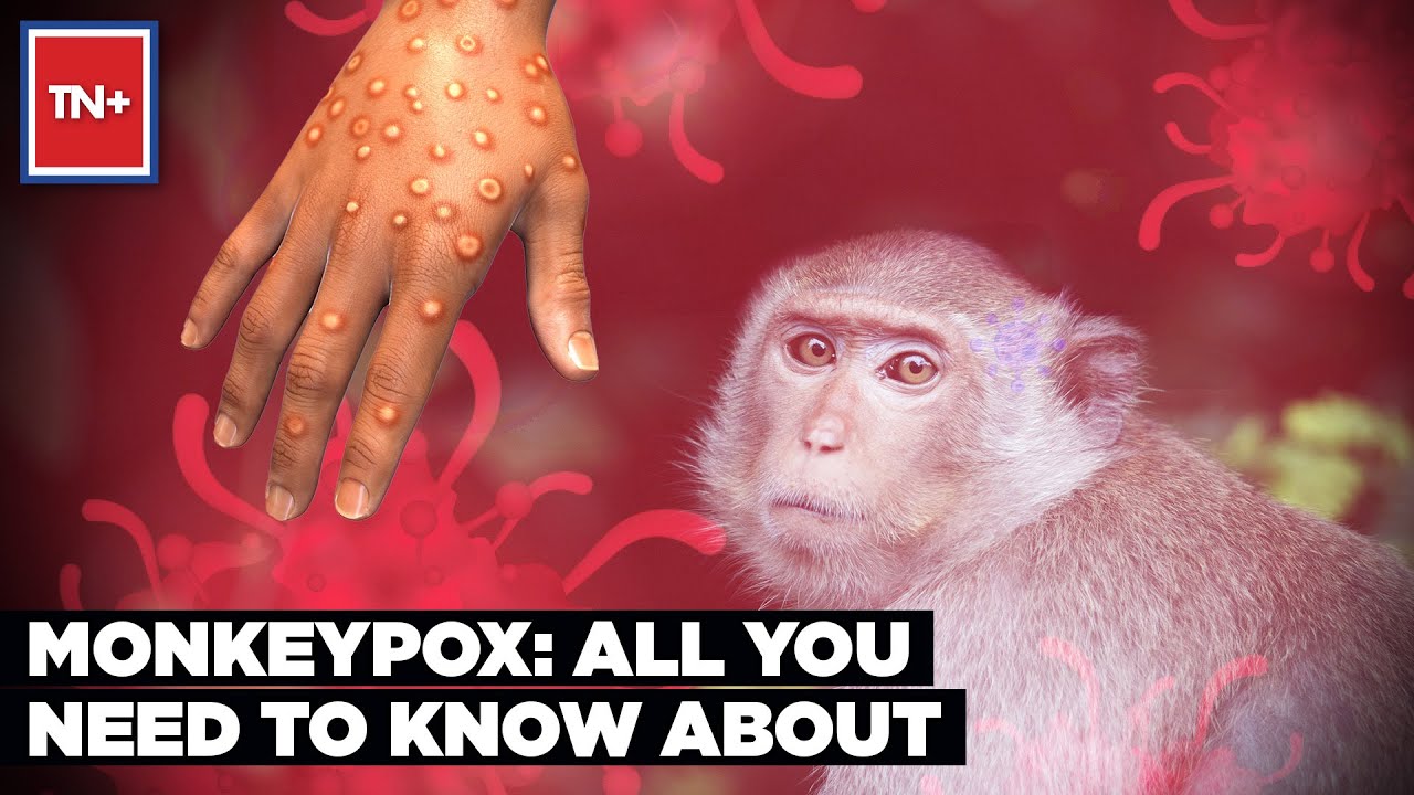Monkeypox: All You Need To Know | Monkeypox Virus Explained | Times Now Plus