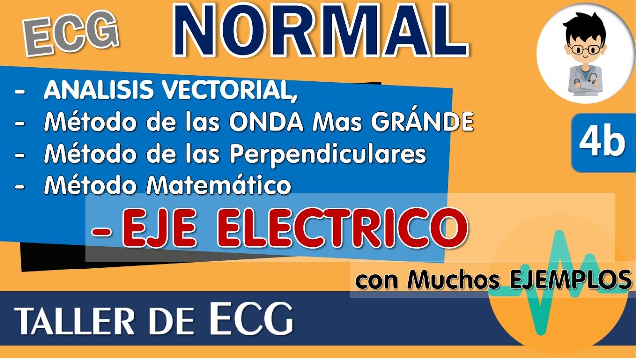 MÉTODOS para calcular el EJE ELECTRICO CARDIACO en el ELECTROCARDIOGRAMA, ANALISIS VECTORIAL, casos!