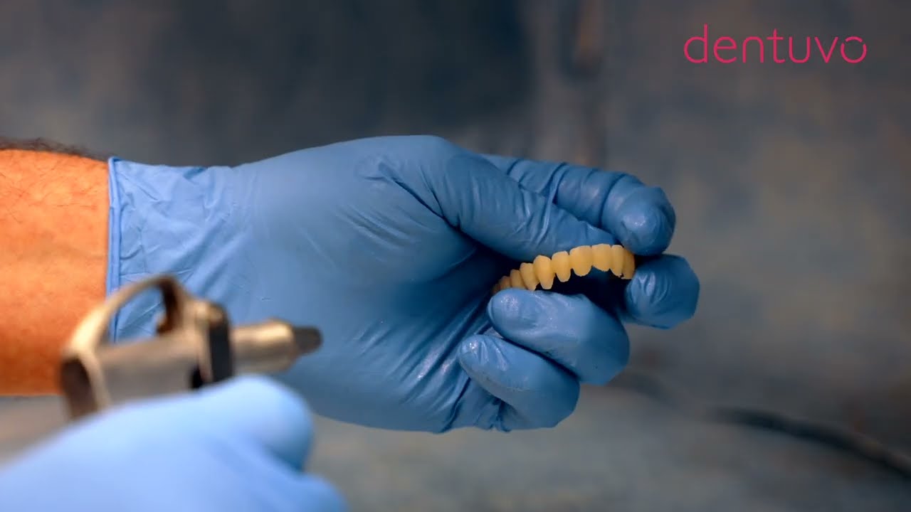 Dentuvo - a digital denture, perfectly crafted