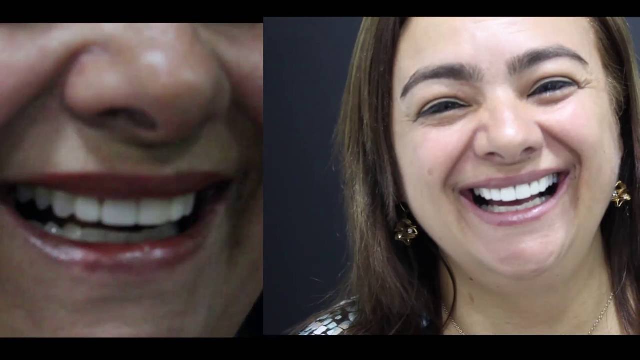 DO&Ntilde;A GLORIA ES FELIZ EN ORALSTUDIO