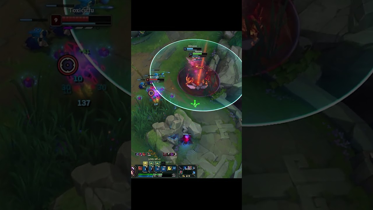 Accurate Bomb! "Just Ziggs Sup thing" - Bomba