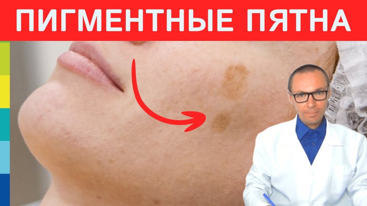 Этот ДЕФИЦИТ вызывает Возрастные Пигментные Пятна! ✍️