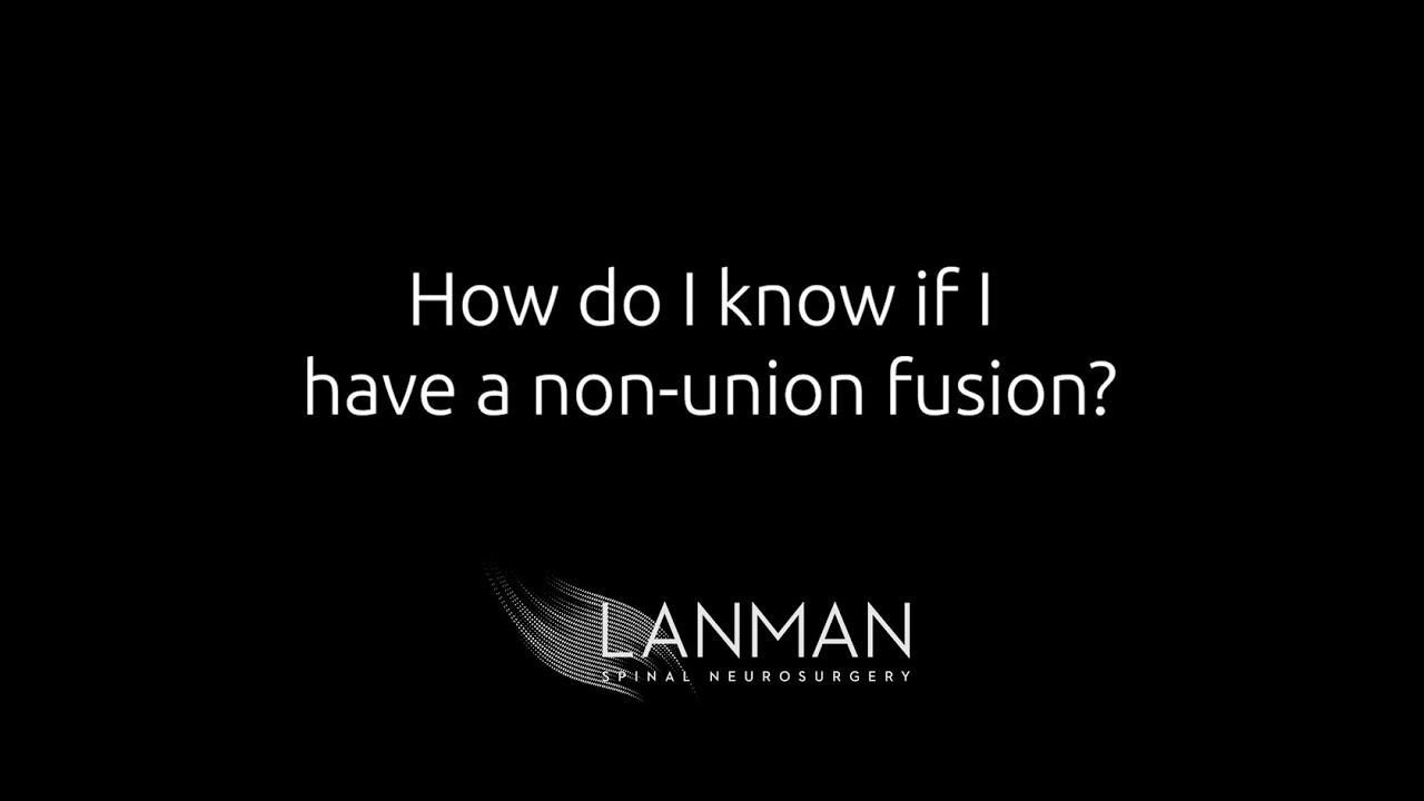 How do I know if I have a non-union fusion? | Dr. Todd Lanman