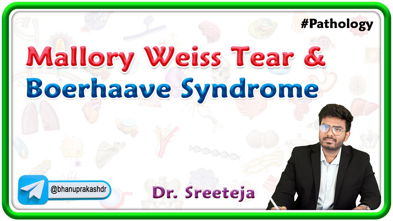 5. Mallory Weiss Tear & Boerhaave Syndrome : USMLE Step 1 Pathology