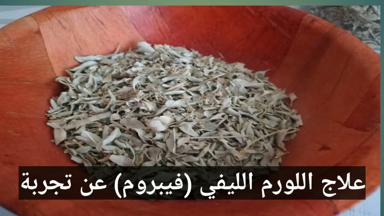 علاج اللورم الليفي(فيبروم) عن تجربة   بالاعشاب عن تجربة امي