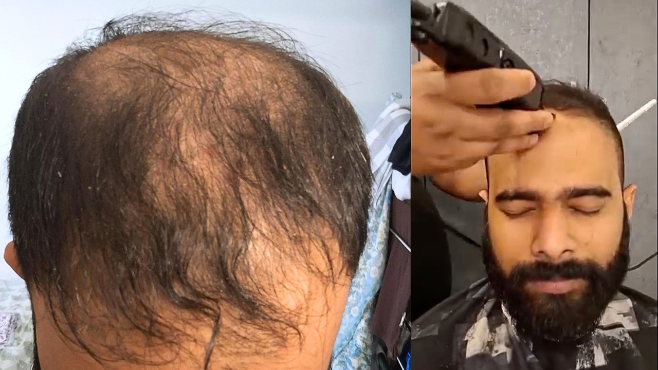 Golenie moich przerzedzonych włos&oacute;w na łyso (maszynką na 1 mm) 🇮🇳