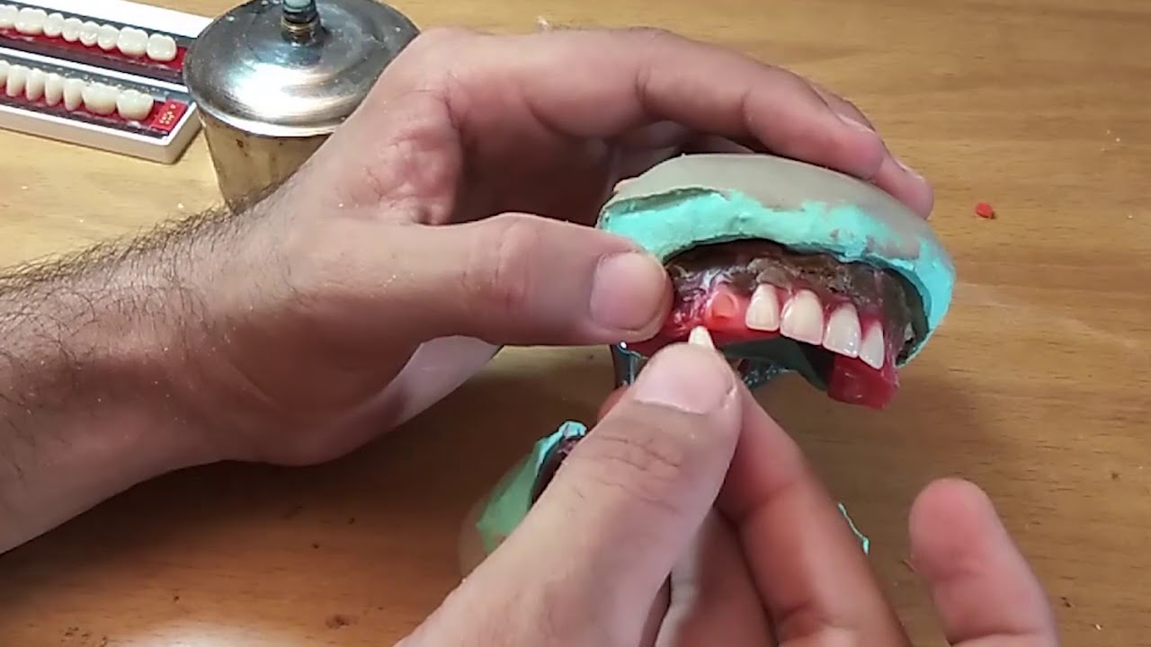 Teeth setting in complete denture