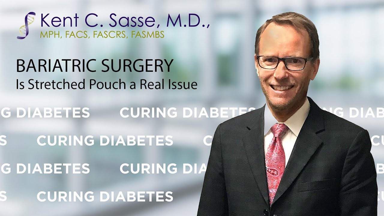 Is a Stretched Pouch After Gastric Surgery a Real Issue? Here's What Dr. Sasse Wants You to Know