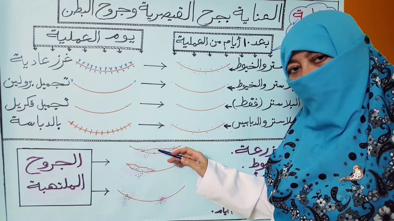 كيفية العناية بجرح القيصرية وجروح البطن..