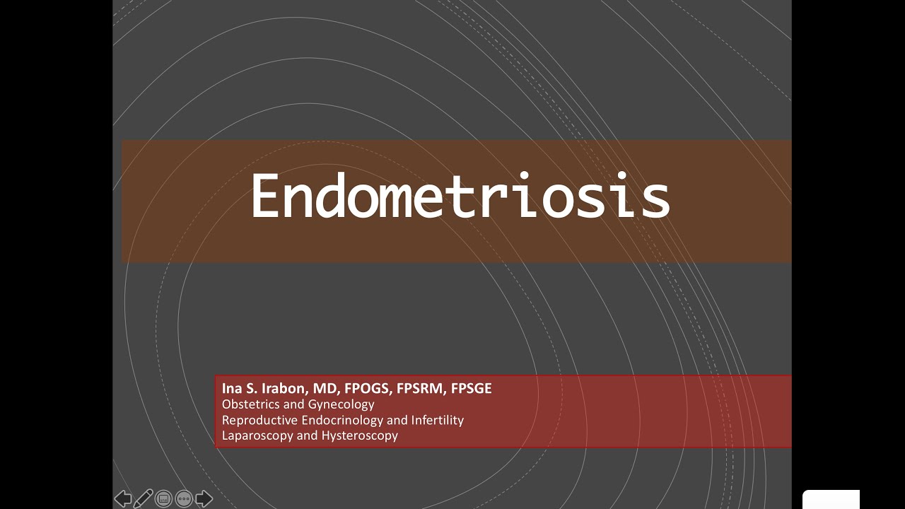 Endometriosis