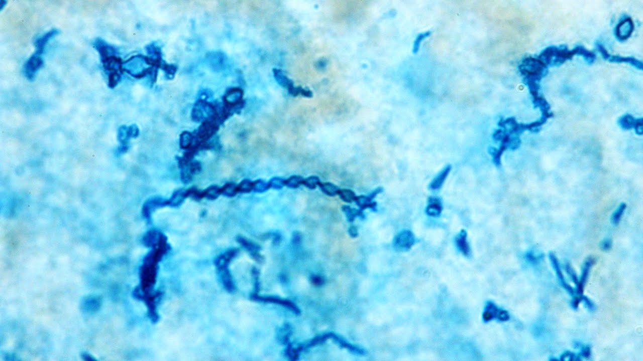 Iron oxidizing bacteria