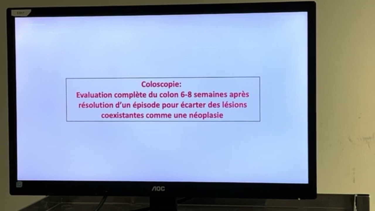 Prise en charge des diverticulites aigues