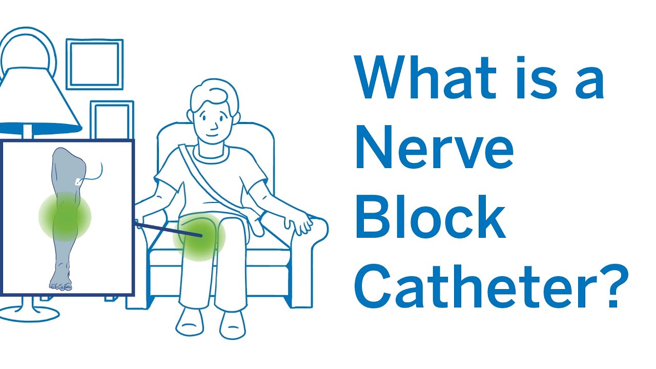 What is a Nerve Block Catheter? Improving Pain Relief After Surgery