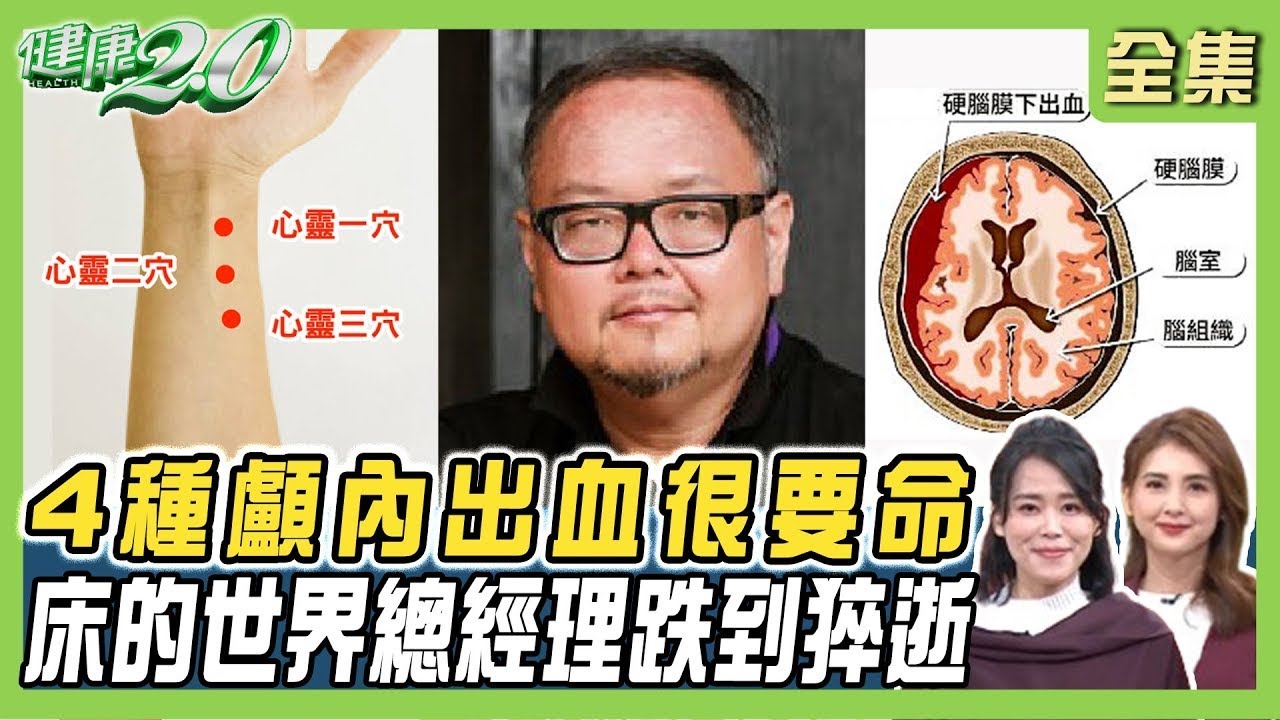 4種顱內出血很要命！上下樓梯腦傷高3倍 影帝腦出血康復 4成有肢體痙攣症狀 反向復健重塑神經！ #健康2.0 20250104【#完整版】陳欣湄 韋汝 陳品元 侯鐘堡 梁惠雯 沈瑞斌 林秋香