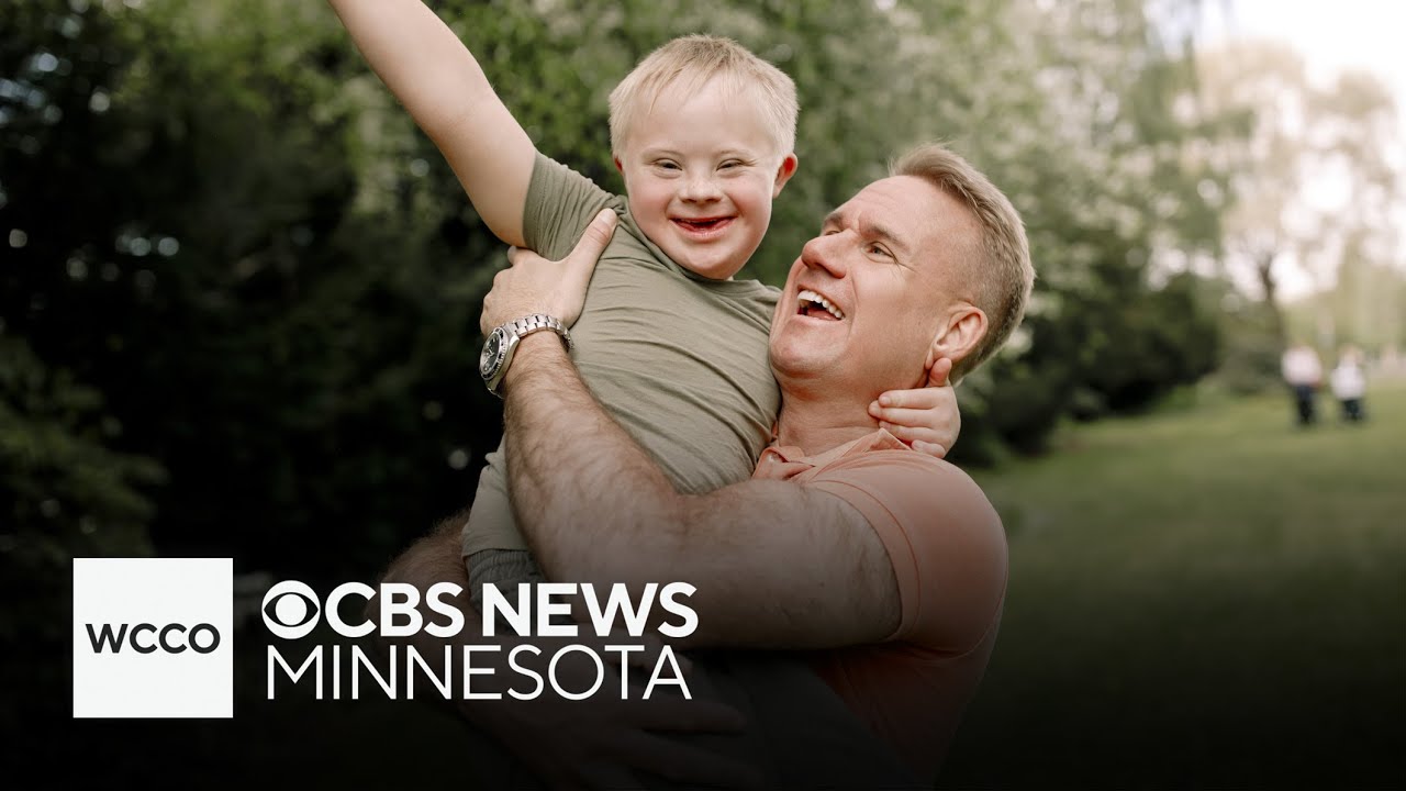 World Down Syndrome Day works to raise awareness, support