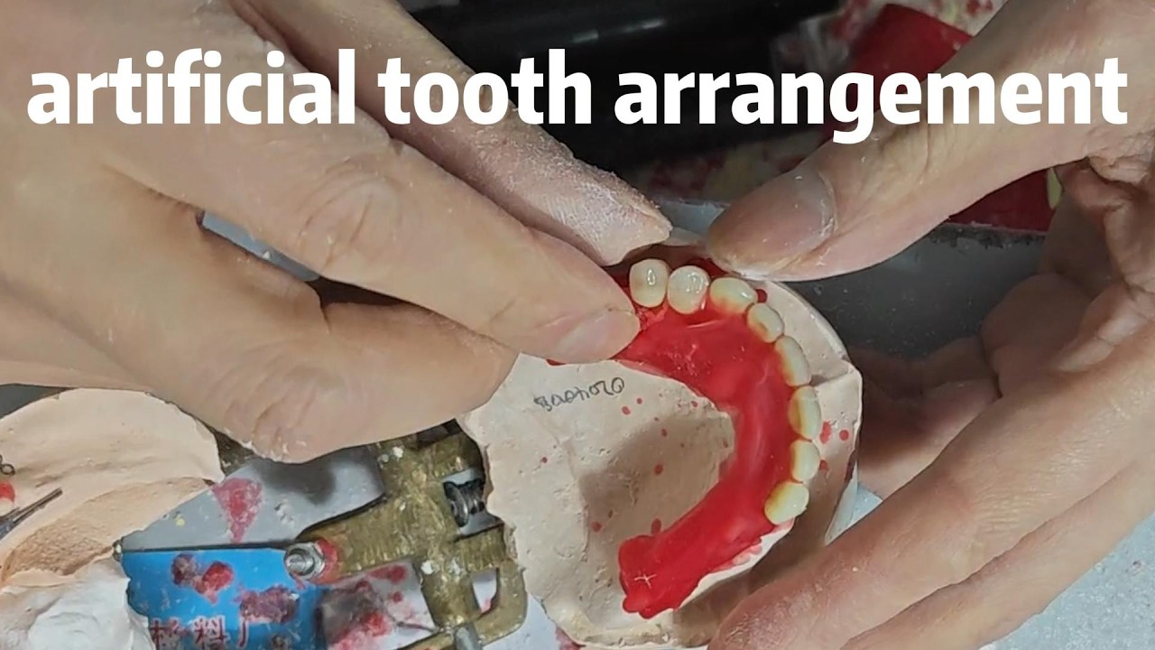 Dental Arrangement Skills | Finish a Full Arch Easily#Dentistry #Denture #DentureTech