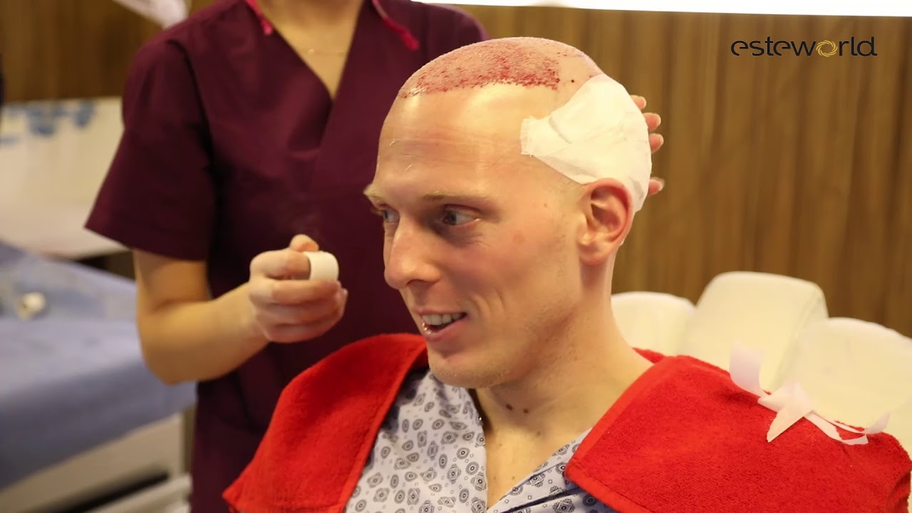 Thom Haartransplantatie bij Esteworld