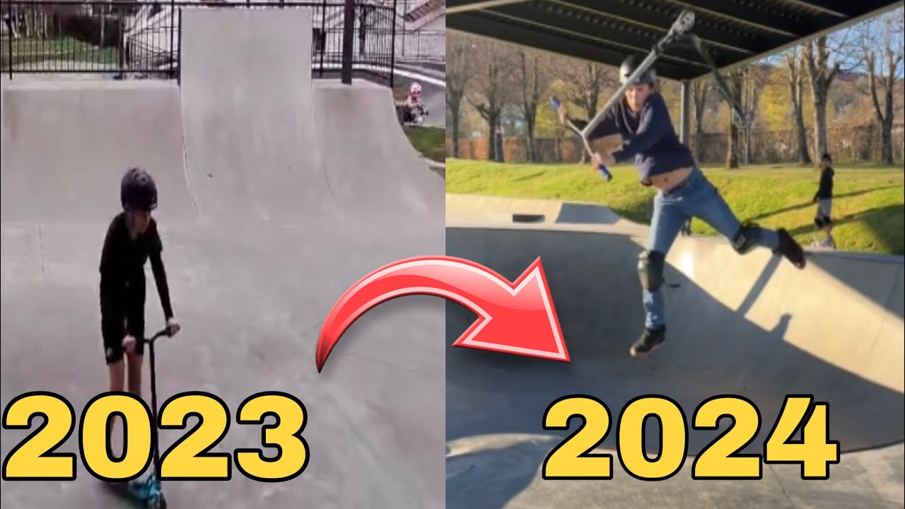 My 1 Year Scooter Progression