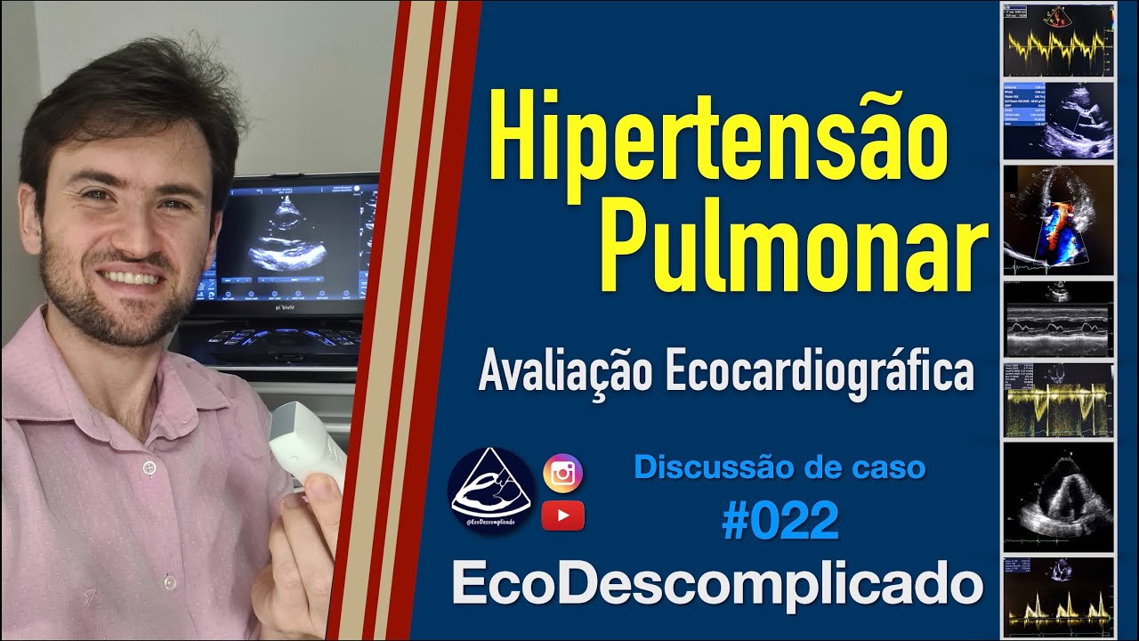 EcoDescomplicado - Discussão de caso AO VIVO #022 -Ecocardiograma na Hipertensão Pulmonar (HP)